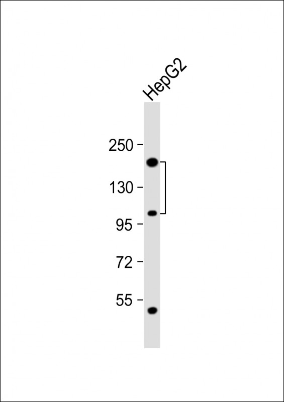 Anti-CORIN Antibody (Center) at 1:1000 dilution + HepG2 whole cell lysateLysates/proteins at 20 �g per lane. SecondaryGoat Anti-Rabbit IgG,  (H+L), Peroxidase conjugated at 1/10000 dilution. Predicted band size : 116 kDaBlocking/Dilution buffer: 5% NFDM/TBST.
