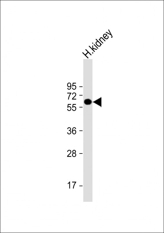 WB - ETFDH Antibody (N-term) AP6877a