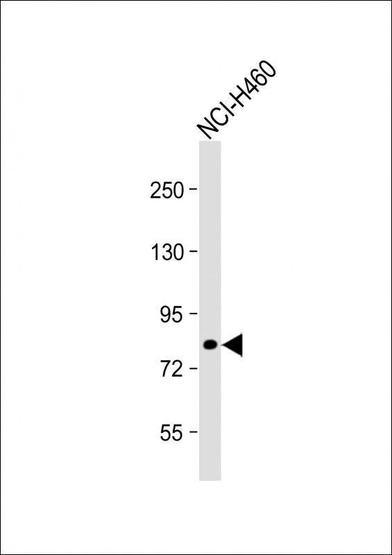 Anti-CASC3 Antibody (Y181) at 1:1000 dilution + NCI-H460 whole cell lysateLysates/proteins at 20 �g per lane. SecondaryGoat Anti-Rabbit IgG,  (H+L), Peroxidase conjugated at 1/10000 dilution. Predicted band size : 76 kDaBlocking/Dilution buffer: 5% NFDM/TBST.