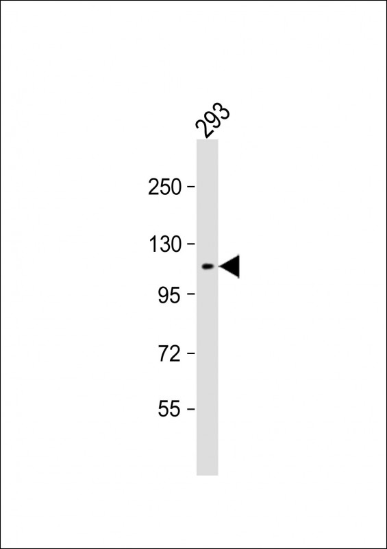 Anti-KIT Antibody (Y721) at 1:1000 dilution + 293 whole cell lysateLysates/proteins at 20 �g per lane. SecondaryGoat Anti-Rabbit IgG,  (H+L), Peroxidase conjugated at 1/10000 dilution. Predicted band size : 110 kDaBlocking/Dilution buffer: 5% NFDM/TBST.