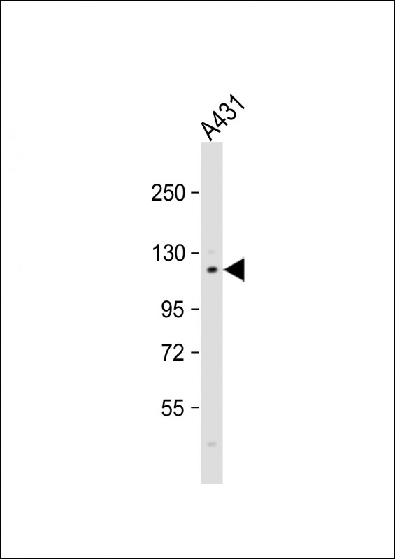 Anti-FAK1 Antibdoy (Y576) at 1:1000 dilution + A431 whole cell lysateLysates/proteins at 20 �g per lane. SecondaryGoat Anti-Rabbit IgG,  (H+L), Peroxidase conjugated at 1/10000 dilution. Predicted band size : 119 kDaBlocking/Dilution buffer: 5% NFDM/TBST.