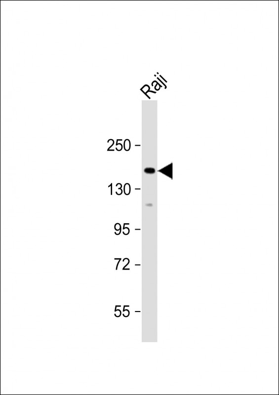 Anti-MAP3K5 Antibody (S1033) at 1:2000 dilution + Raji whole cell lysateLysates/proteins at 20 �g per lane. SecondaryGoat Anti-Rabbit IgG,  (H+L), Peroxidase conjugated at 1/10000 dilution. Predicted band size : 155 kDaBlocking/Dilution buffer: 5% NFDM/TBST.