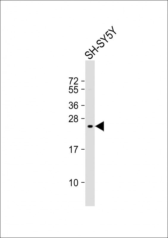 WB - KIP2 Antibody (N-term) AP8158a