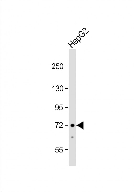 Anti-ACSS3 Antibody (Center) at 1:1000 dilution + HepG2 whole cell lysateLysates/proteins at 20 �g per lane. SecondaryGoat Anti-Rabbit IgG,  (H+L), Peroxidase conjugated at 1/10000 dilution. Predicted band size : 75 kDaBlocking/Dilution buffer: 5% NFDM/TBST.