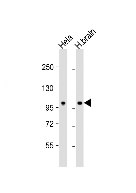 All lanes : Anti-NCOA7 Antibody (N-term) at 1:1000 dilutionLane 1: Hela whole cell lysateLane 2: human brain lysateLysates/proteins at 20 �g per lane. SecondaryGoat Anti-Rabbit IgG,  (H+L), Peroxidase conjugated at 1/10000 dilution. Predicted band size : 106 kDaBlocking/Dilution buffer: 5% NFDM/TBST.