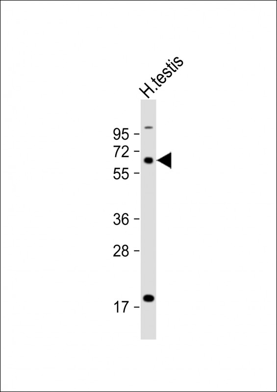Anti-ACBG2 Antibody (Center) at 1:1000 dilution + human testis lysateLysates/proteins at 20 �g per lane. SecondaryGoat Anti-Rabbit IgG,  (H+L), Peroxidase conjugated at 1/10000 dilution. Predicted band size : 74 kDaBlocking/Dilution buffer: 5% NFDM/TBST.