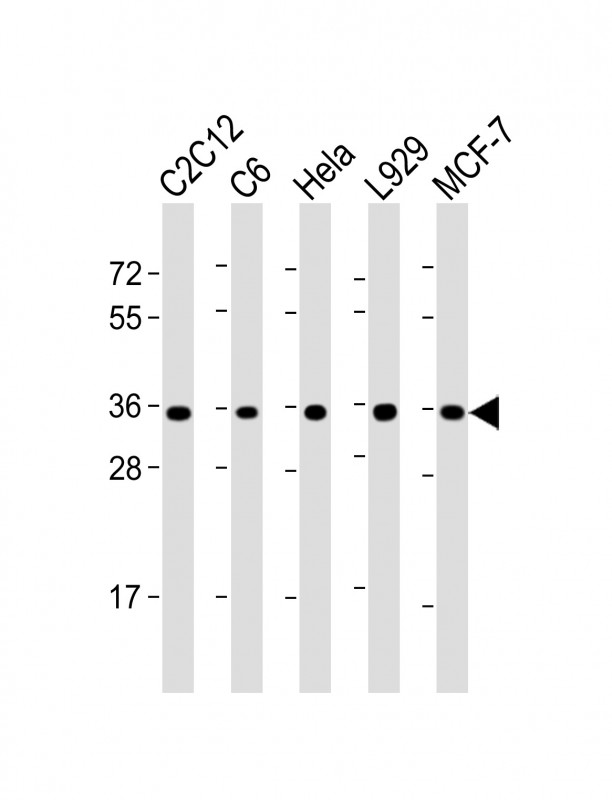 All lanes : Anti-PCNA Antibody (C-term) at 1:2000 dilutionLane 1: C2C12 whole cell lysateLane 2: C6 whole cell lysateLane 3: Hela whole cell lysateLane 4: L929 whole cell lysateLane 5: MCF-7 whole cell lysateLysates/proteins at 20 �g per lane. SecondaryGoat Anti-mouse IgG,  (H+L), Peroxidase conjugated at 1/10000 dilution. Predicted band size : 29 kDaBlocking/Dilution buffer: 5% NFDM/TBST.