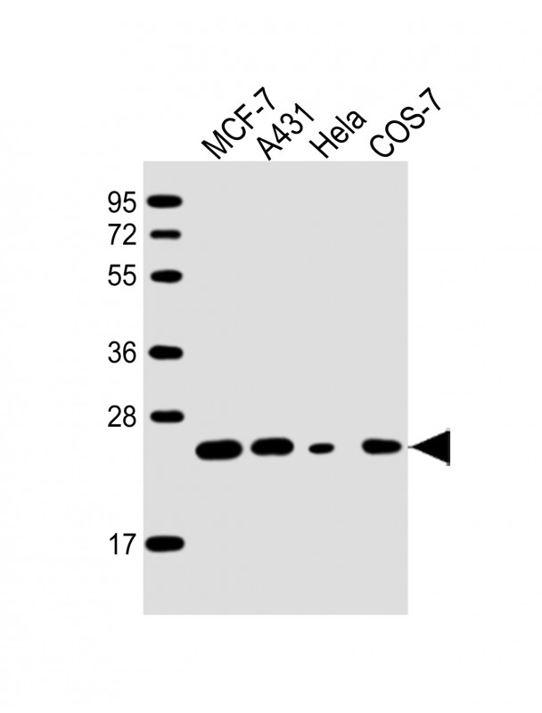 All lanes : Anti-RAB21 Antibody at 1:2000 dilutionLane 1: MCF-7 whole cell lysateLane 2: A431 whole cell lysateLane 3: Hela whole cell lysateLane 4: COS-7 whole cell lysateLysates/proteins at 20 �g per lane.  SecondaryGoat Anti-mouse IgG,   (H+L),  Peroxidase conjugated at 1/10000 dilution.  Predicted band size : 24 kDaBlocking/Dilution buffer: 5% NFDM/TBST.