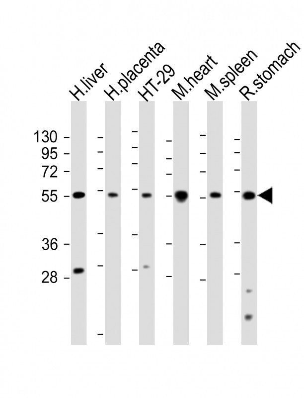 WB - HTR2B Antibody (C-term E423) AP11124a
