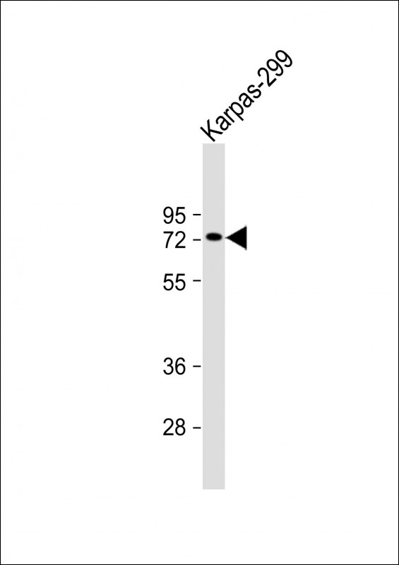 Anti-PIAS1 Antibody (R621) at 1:1000 dilution + Karpas-299 whole cell lysateLysates/proteins at 20 �g per lane. SecondaryGoat Anti-Rabbit IgG,  (H+L), Peroxidase conjugated at 1/10000 dilution. Predicted band size : 72 kDaBlocking/Dilution buffer: 5% NFDM/TBST.