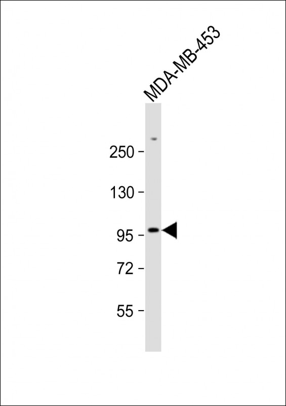 WB - ZBTB49 Antibody (N-term) AP17720a