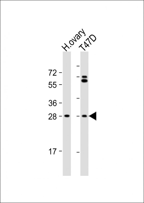 WB - FIGLA Antibody (Center) AP18020c