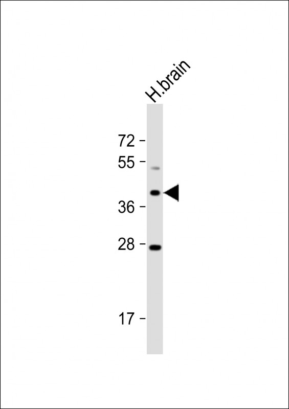 WB - OR5M8 Antibody (C-term) AP18932b