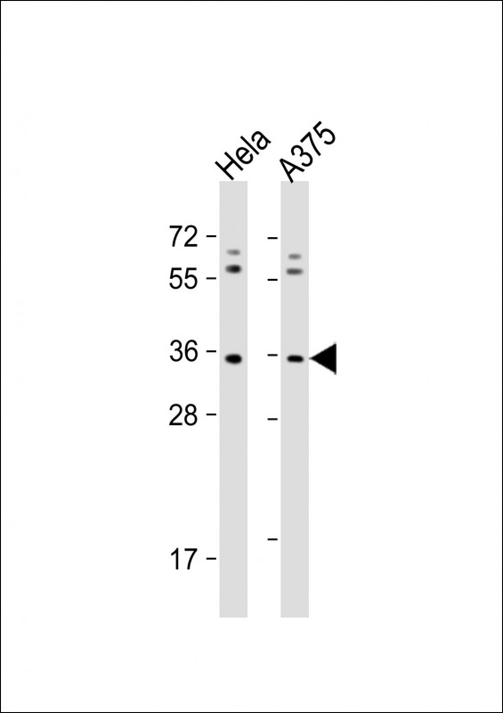 WB - OR5AK2 Antibody (C-term) AP19051b