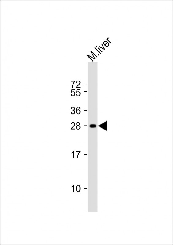 WB - Mouse Sike1 Antibody (N-term) AP20223a