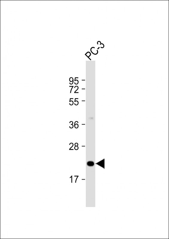 Anti-APOBEC3C Antibody (C-Term) at 1:2000 dilution + PC-3 whole cell lysateLysates/proteins at 20 �g per lane. SecondaryGoat Anti-Rabbit IgG,  (H+L), Peroxidase conjugated at 1/10000 dilution. Predicted band size : 23 kDaBlocking/Dilution buffer: 5% NFDM/TBST.