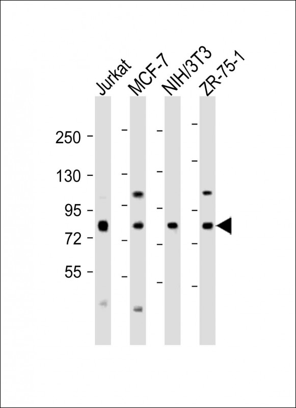 All lanes : Anti-ARHGEF7 Antibody (C-Term) at 1:2000 dilutionLane 1: Jurkat whole cell lysateLane 2: MCF-7 whole cell lysateLane 3: NIH/3T3 whole cell lysateLane 4: ZR-75-1 whole cell lysateLysates/proteins at 20 �g per lane. SecondaryGoat Anti-Rabbit IgG,  (H+L), Peroxidase conjugated at 1/10000 dilution. Predicted band size : 90 kDaBlocking/Dilution buffer: 5% NFDM/TBST.