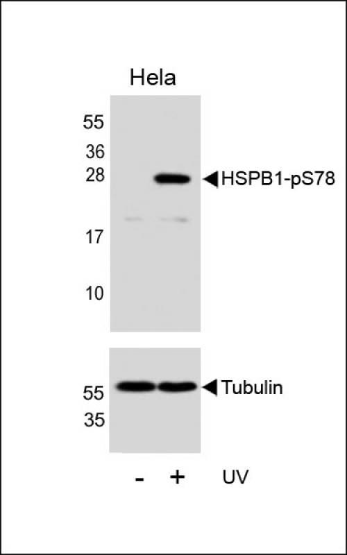 Western blot analysis of lysates from Hela cell line, untreated or treated with UV, 2 hours, using HSPB1 Antibody(RB56433)(upper) or Tubulin (lower).