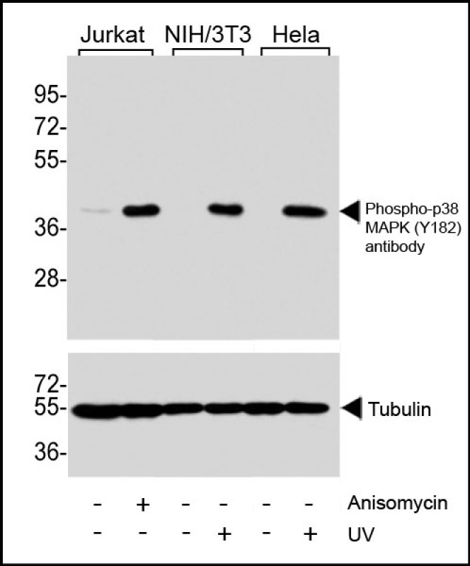 Western blot analysis of extracts from Jurkat cells,  untreated or treated with anisomycin (25 �g/ml),  NIH/3T3 and Hela cells, untreated or treated with UV (30 minutes), using Phospho-p38 MAPK (Y182) antibody (upper) or Tubulin (lower).