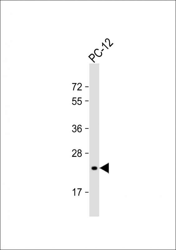 Anti-DHFR Antibody (C-term) at 1:2000 dilution + PC-12 whole cell lysateLysates/proteins at 20 �g per lane. SecondaryGoat Anti-Rabbit IgG,  (H+L), Peroxidase conjugated at 1/10000 dilution. Predicted band size : 22 kDaBlocking/Dilution buffer: 5% NFDM/TBST.