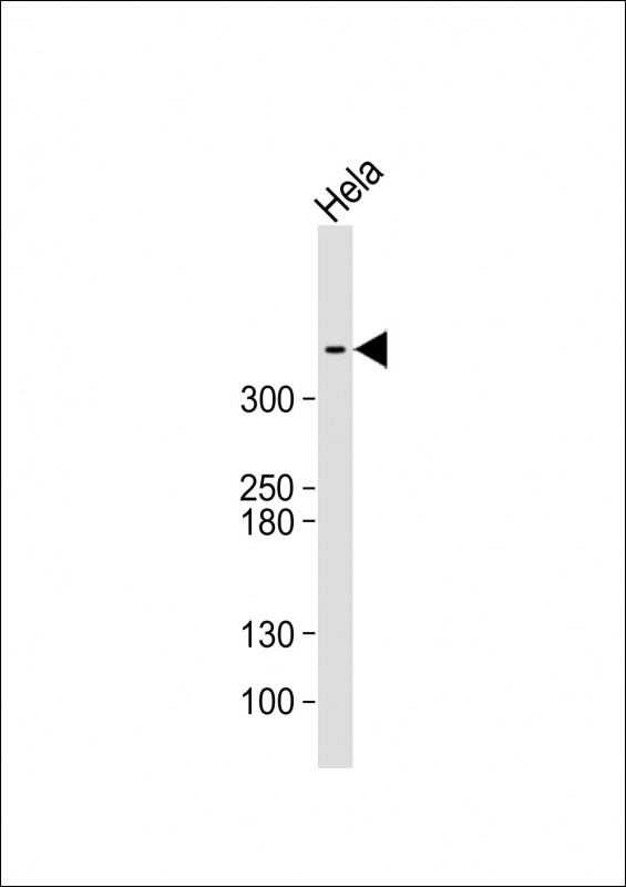 Anti-ATM Antibody (C-term) at 1:500 dilution + Hela whole cell lysateLysates/proteins at 20 �g per lane. SecondaryGoat Anti-Rabbit IgG,  (H+L), Peroxidase conjugated at 1/10000 dilution. Predicted band size : 351 kDaBlocking/Dilution buffer: 5% NFDM/TBST.