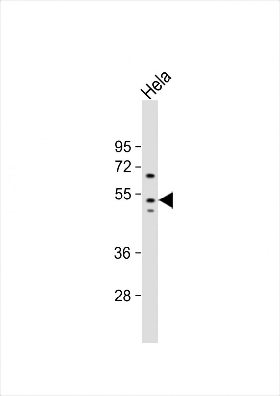 Anti-GSK3A Antibody (S21) at 1:1000 dilution + Hela whole cell lysateLysates/proteins at 20 �g per lane. SecondaryGoat Anti-Rabbit IgG,  (H+L), Peroxidase conjugated at 1/10000 dilution. Predicted band size : 51 kDaBlocking/Dilution buffer: 5% NFDM/TBST.