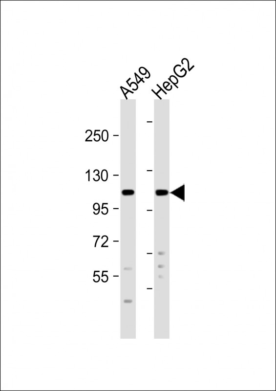WB - PERK (EIF2AK3) Antibody (Center) AP8150c