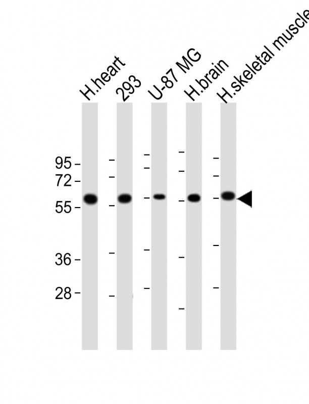 All lanes : Anti-ENTPD2 Antibody at 1:1000 dilutionLane 1: human heart lysateLane 2: 293 whole cell lysateLane 3: U-87 MG whole cell lysateLane 4: human brain lysateLane 5: human skeletal muscle lysateLysates/proteins at 20 �g per lane. SecondaryGoat Anti-Rabbit IgG,  (H+L), Peroxidase conjugated at 1/10000 dilution. Predicted band size : 54 kDaBlocking/Dilution buffer: 5% NFDM/TBST.