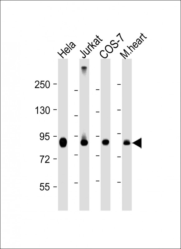 All lanes : Anti-PFKP Antibody (C-term) at 1:4000 dilutionLane 1: Hela whole cell lysateLane 2: Jurkat whole cell lysateLane 3: COS-7 whole cell lysateLane 4: mouse heart lysateLysates/proteins at 20 �g per lane.   SecondaryGoat Anti-mouse IgG,    (H+L),   Peroxidase conjugated at 1/10000 dilution.   Predicted band size : 86 kDaBlocking/Dilution buffer: 5% NFDM/TBST.