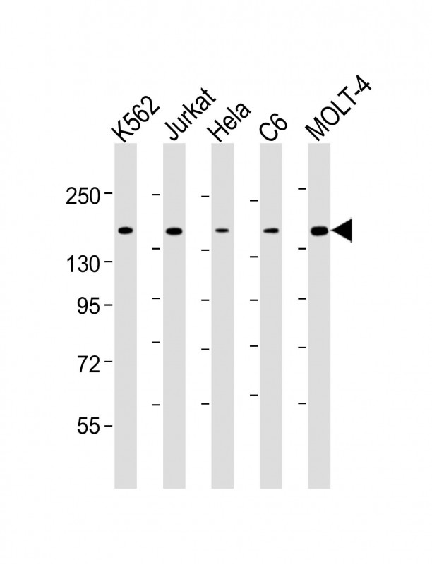 All lanes : Anti-CTCF Antibody at 1:4000 dilutionLane 1: K562 whole cell lysateLane 2: Jurkat whole cell lysateLane 3: Hela whole cell lysateLane 4: C6 whole cell lysateLane 5: MOLT-4 whole cell lysateLysates/proteins at 20 �g per lane.  SecondaryGoat Anti-mouse IgG,   (H+L),  Peroxidase conjugated at 1/10000 dilution.  Predicted band size : 83 kDaBlocking/Dilution buffer: 5% NFDM/TBST.