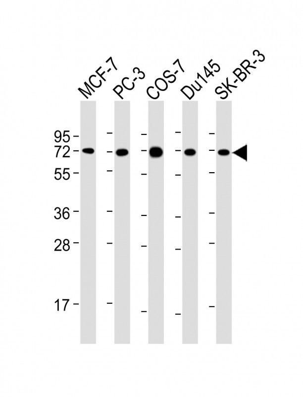 All lanes : Anti-USP2 Antibody at 1:2000 dilutionLane 1: MCF-7 whole cell lysateLane 2: PC-3 whole cell lysateLane 3: COS-7 whole cell lysateLane 4: Du145 whole cell lysateLane 5: SK-BR-3 whole cell lysateLysates/proteins at 20 �g per lane. SecondaryGoat Anti-mouse IgG,  (H+L), Peroxidase conjugated at 1/10000 dilution. Predicted band size : 68 kDaBlocking/Dilution buffer: 5% NFDM/TBST.