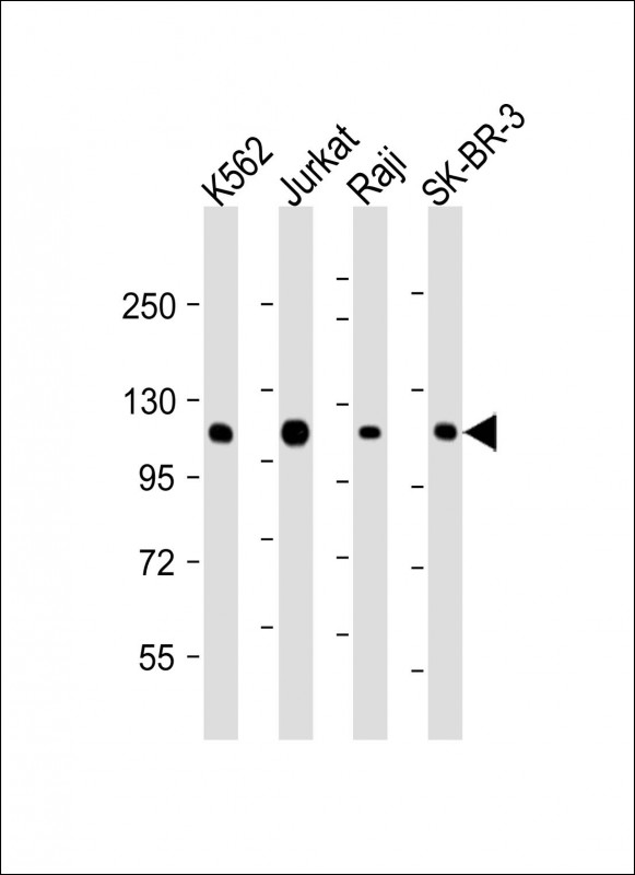 All lanes : Anti-CBL Antibody at 1:2000 dilutionLane 1: K562 whole cell lysateLane 2: Jurkat whole cell lysateLane 3: Raji whole cell lysateLane 4: SK-BR-3 whole cell lysateLysates/proteins at 20 �g per lane.  SecondaryGoat Anti-mouse IgG,   (H+L),  Peroxidase conjugated at 1/10000 dilution.  Predicted band size : 100 kDaBlocking/Dilution buffer: 5% NFDM/TBST.