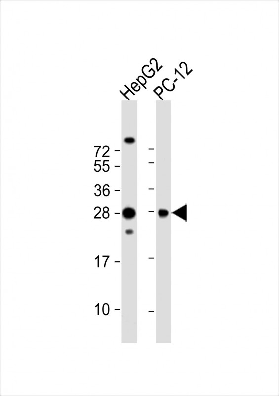 All lanes : Anti-PCMT1 Antibody (N-Term) at 1:2000 dilutionLane 1: HepG2 whole cell lysateLane 2: PC-12 whole cell lysateLysates/proteins at 20 �g per lane. SecondaryGoat Anti-Rabbit IgG,  (H+L), Peroxidase conjugated at 1/10000 dilution. Predicted band size : 25 kDaBlocking/Dilution buffer: 5% NFDM/TBST.