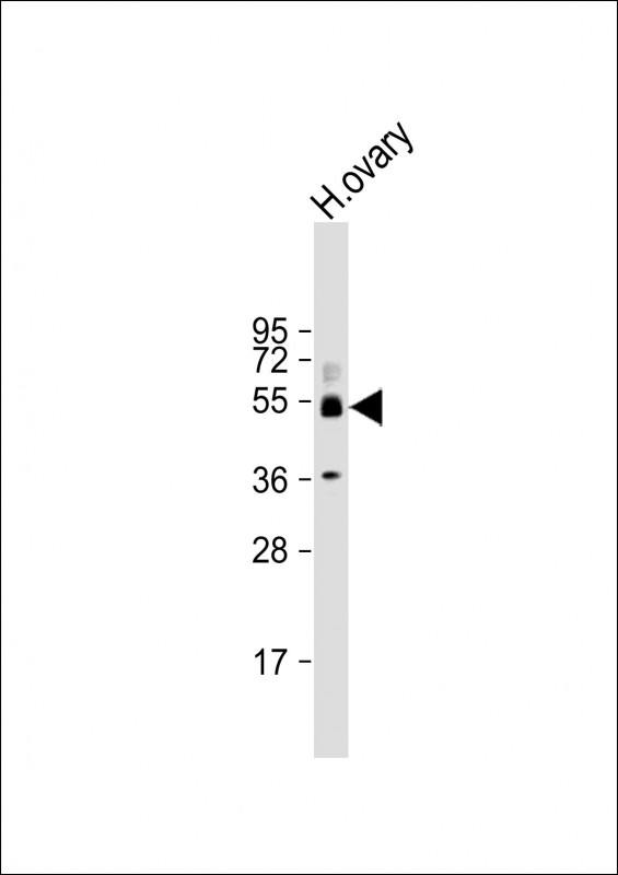 WB - SH3BP5 Antibody (N-Term) AP22165a