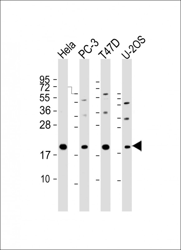 All lanes : Anti-ANAPC11 Antibody (C-Term) at 1:2000 dilutionLane 1: Hela whole cell lysateLane 2: PC-3 whole cell lysateLane 3: T47D whole cell lysateLane 4: U-2OS whole cell lysateLysates/proteins at 20 �g per lane. SecondaryGoat Anti-Rabbit IgG,  (H+L), Peroxidase conjugated at 1/10000 dilution. Predicted band size : 10 kDaBlocking/Dilution buffer: 5% NFDM/TBST.
