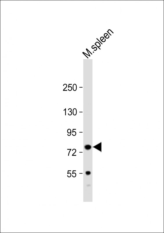 WB - FERMT3 Antibody (N-Term) AP22172a