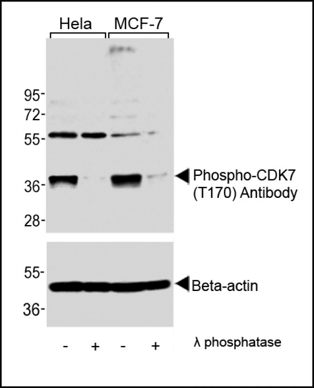 Western blot analysis of extracts from Hela and MCF-7 cells,  untreated or lamda phosphatase-treated,  using Phospho-CDK7(T170) Antibody (upper) or Beta-actin (lower).