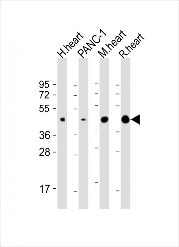 All lanes : Anti-WNT5A Antibody (Center) at 1:2000  dilutionLane 1: human heart lysateLane 2: PANC-1 whole cell lysateLane 3: mouse heart lysateLane 4: rat heart lysateLysates/proteins at 20 �g per lane. SecondaryGoat Anti-Rabbit IgG,  (H+L), Peroxidase conjugated at 1/10000 dilution. Predicted band size : 42 kDaBlocking/Dilution buffer: 5% NFDM/TBST.