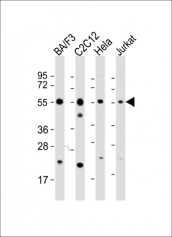 All lanes : Anti-CASP8 Antibody (C-term) at 1:2000 dilutionLane 1: BA/F3 whole cell lysateLane 2: C2C12 whole cell lysateLane 3: Hela whole cell lysateLane 4: Jurkat whole cell lysateLysates/proteins at 20 �g per lane.  SecondaryGoat Anti-Rabbit IgG,   (H+L),  Peroxidase conjugated at 1/10000 dilution.  Predicted band size : 55 kDaBlocking/Dilution buffer: 5% NFDM/TBST.