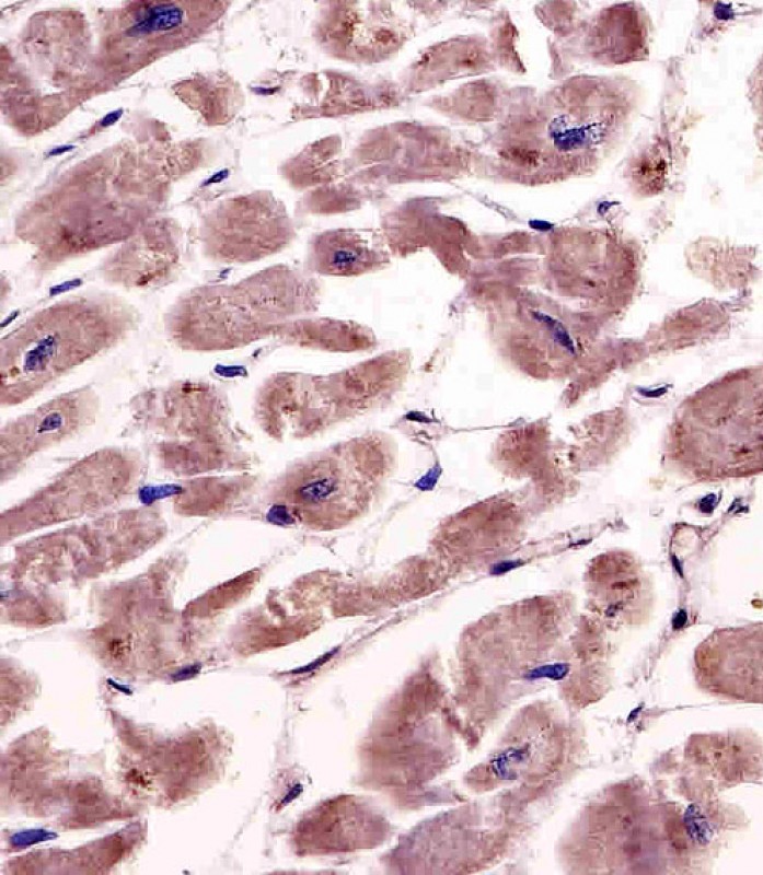 IHC-P - SPHK1 Antibody (Center) AP7237C