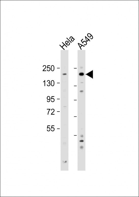 WB - IGF1 Receptor (IGF1R) Antibody (N-term) AP7649a