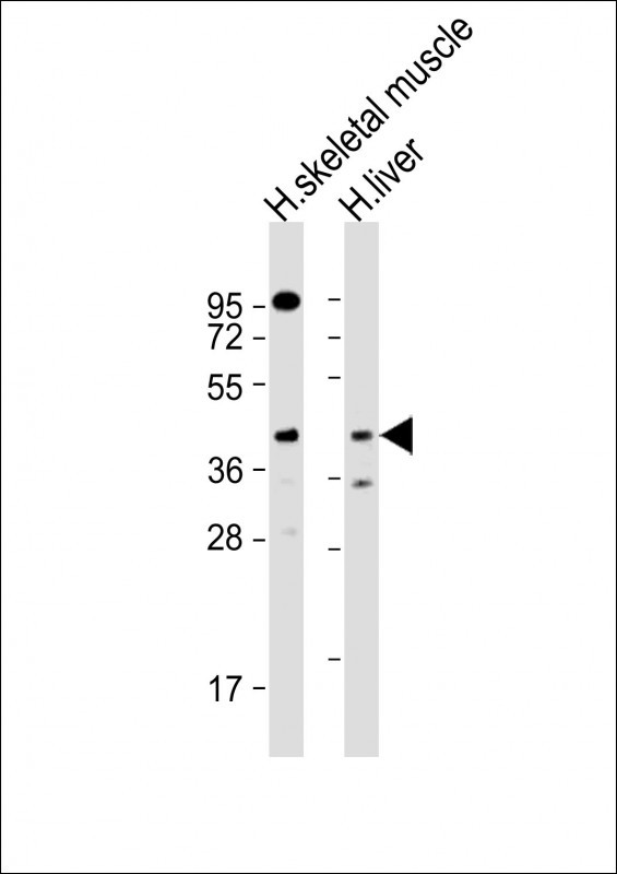 All lanes : Anti-ANGPTL4 Antibody (Center) at 1:1000 dilutionLane 1: human skeletal muscle lysateLane 2: human liver lysateLysates/proteins at 20 �g per lane. SecondaryGoat Anti-Rabbit IgG,  (H+L), Peroxidase conjugated at 1/10000 dilution. Predicted band size : 45 kDaBlocking/Dilution buffer: 5% NFDM/TBST.