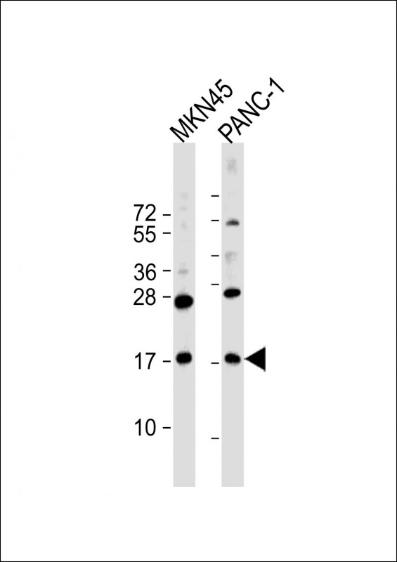 WB - FAM159B Antibody (C-Term) AP22187b