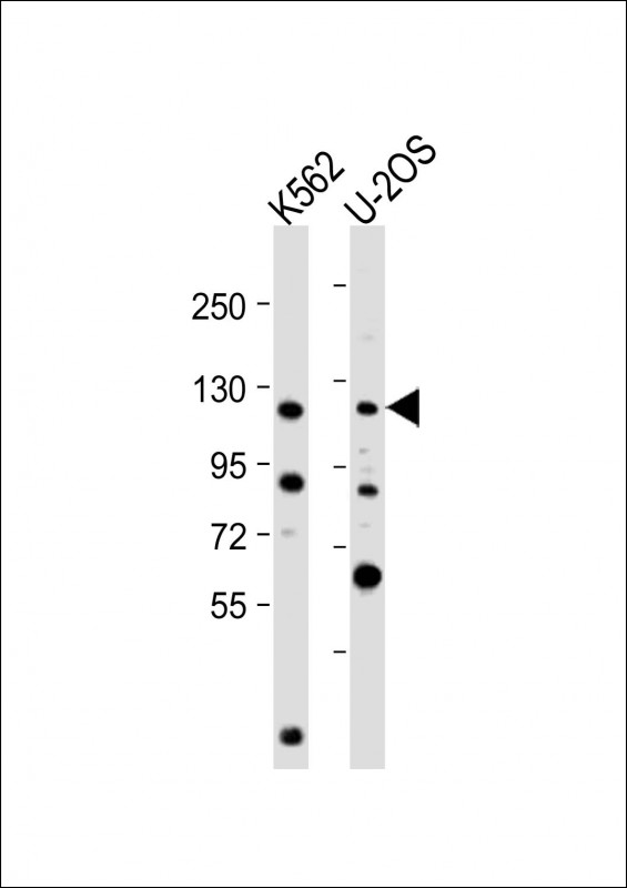 WB - NOP2 Antibody (N-Term) AP22191a