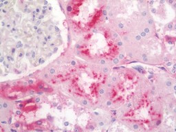 IHC-P - Anti-GC / Vitamin D-Binding Protein Antibody  ALS17284