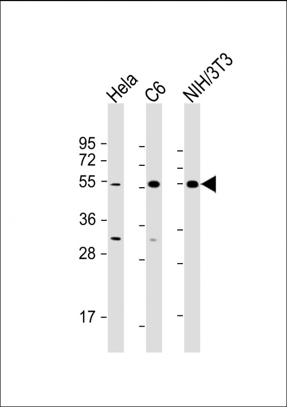 All lanes : Anti-PTEN Antibody (N-term) at 1:500-1:2000 dilutionLane 1: Hela whole cell lysateLane 2: C6 whole cell lysateLane 3: NIH/3T3 whole cell lysateLysates/proteins at 20 �g per lane. SecondaryGoat Anti-mouse IgG,  (H+L), Peroxidase conjugated at 1/10000 dilution. Predicted band size : 47 kDaBlocking/Dilution buffer: 5% NFDM/TBST.