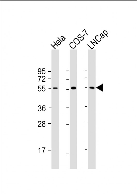 All lanes : Anti-SUFU Antibody at 1:2000 dilutionLane 1: Hela whole cell lysateLane 2: COS-7 whole cell lysateLane 3: LNCap whole cell lysateLysates/proteins at 20 �g per lane. SecondaryGoat Anti-mouse IgG,  (H+L), Peroxidase conjugated at 1/10000 dilution. Predicted band size : 54 kDaBlocking/Dilution buffer: 5% NFDM/TBST.