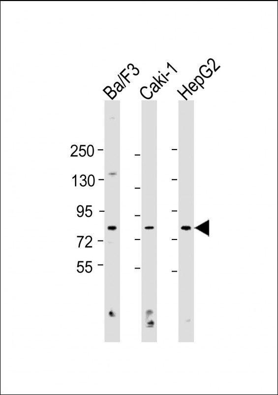 All lanes : Anti-APG7L Antibody (R509) at 1:1000 dilutionLane 1: Ba/F3 whole cell lysateLane 2: Caki-1 whole cell lysateLane 3: HepG2 whole cell lysateLysates/proteins at 20 �g per lane. SecondaryGoat Anti-Rabbit IgG,  (H+L), Peroxidase conjugated at 1/10000 dilution. Predicted band size : 78 kDaBlocking/Dilution buffer: 5% NFDM/TBST.