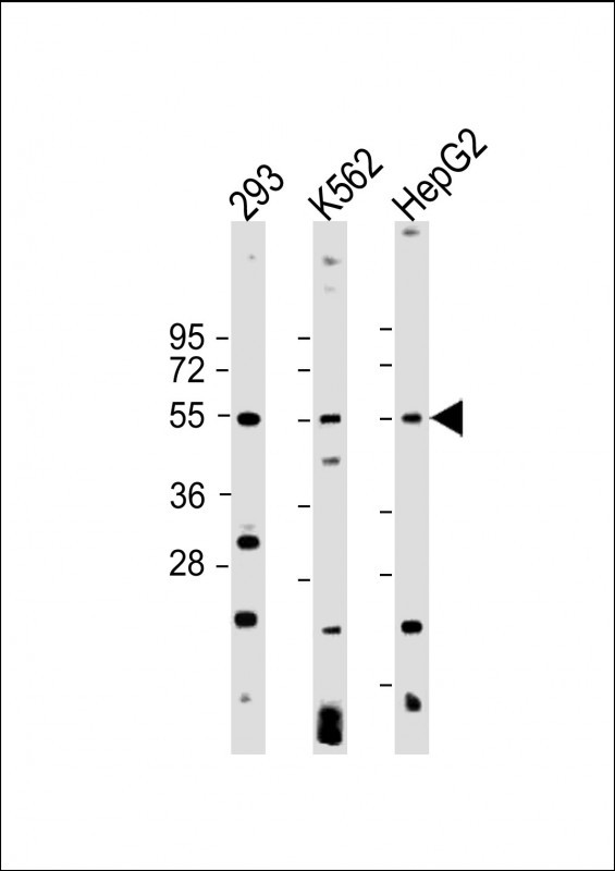 WB - VEGFC Antibody AP2042d
