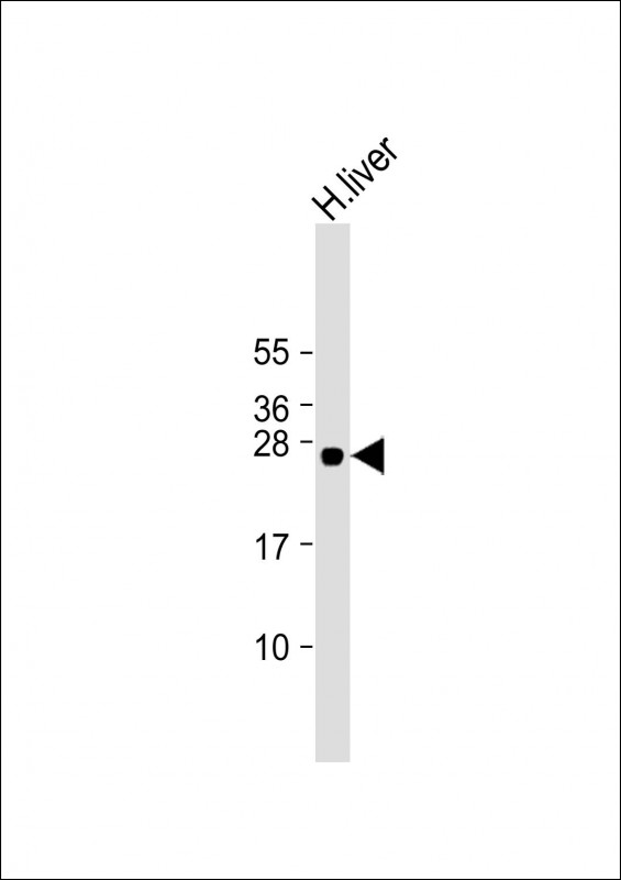 WB - GSTA5 Antibody (Center) AP22214c